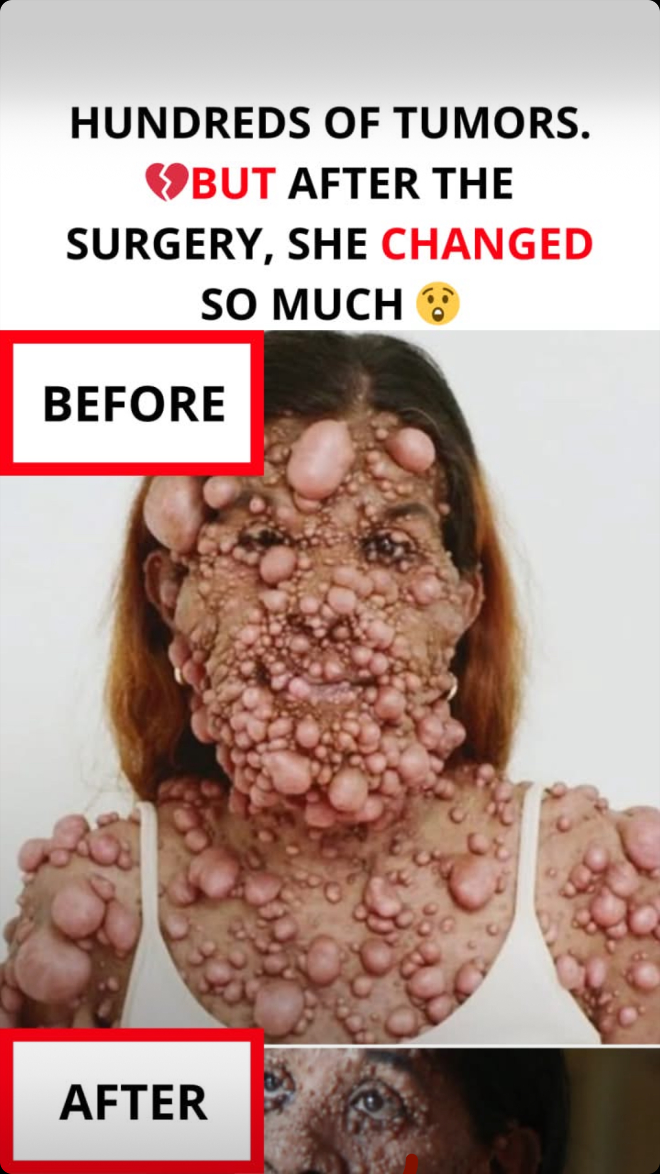 After 24 Surgeries and a Lifetime of Pain, She Finally Saw Her Own Face — and Whispered, ‘I Never Knew I Was This Beautiful