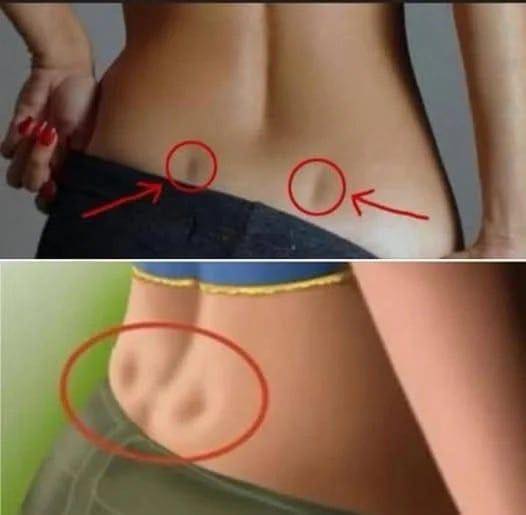 If you have these two holes in your back, it