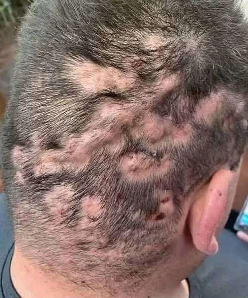 These are actually the first symptoms